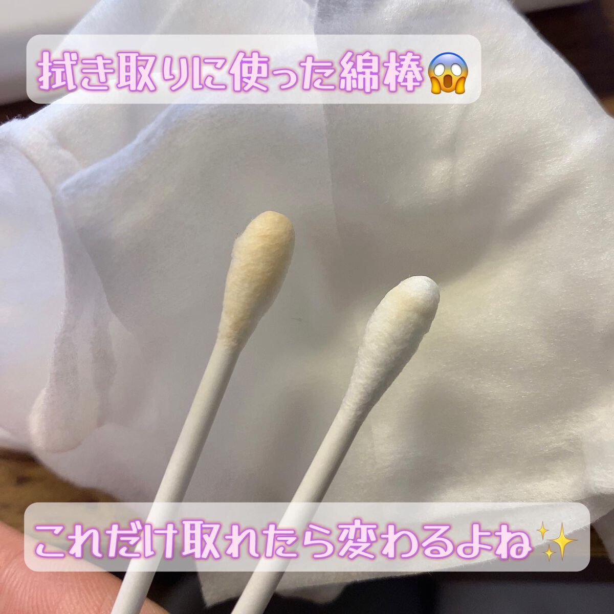 アクレオンセボエクストラクター/ANACIS/その他スキンケアを使ったクチコミ(8枚目)