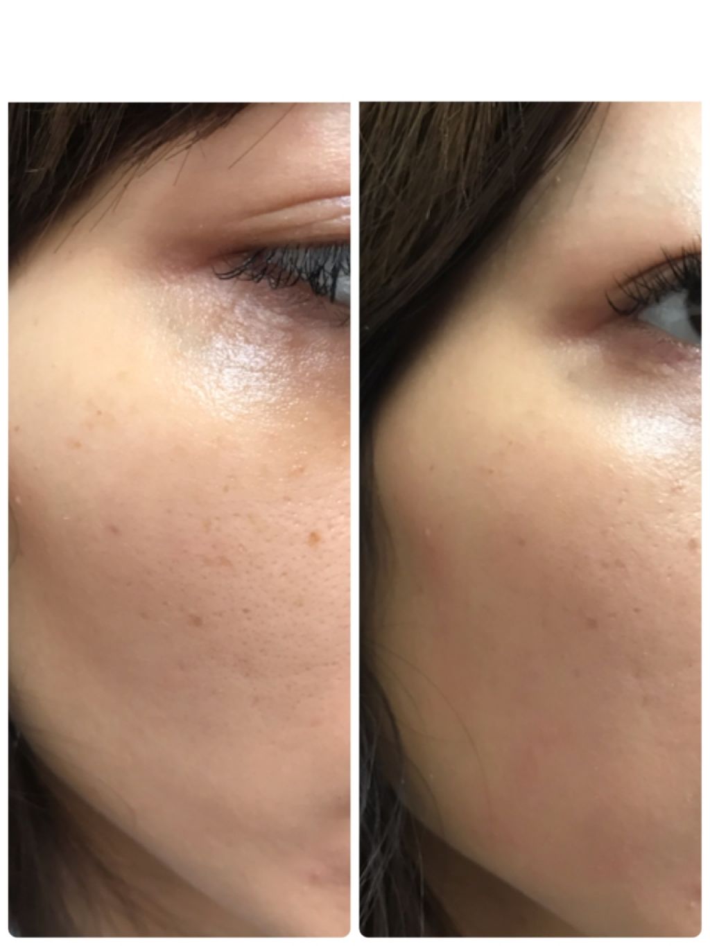 【旧】ディオールスキン フォーエヴァー フルイド グロウ/Dior/リキッドファンデーションを使ったクチコミ(4枚目)