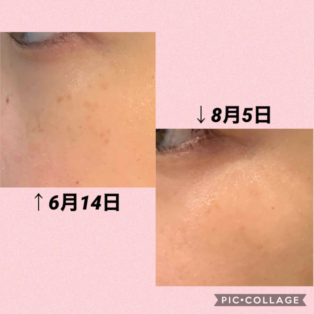 WhiteHQCream（ホワイトエイチキュークリーム）/LANTELNO/フェイスクリームを使ったクチコミ（1枚目）