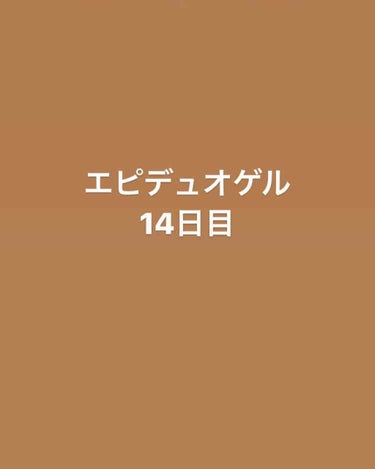 orange_perfume_2opm on LIPS 「今日でちょうど２週間経過！良くなってるのかなあ、、、🙍🏼泣赤み..」（1枚目）