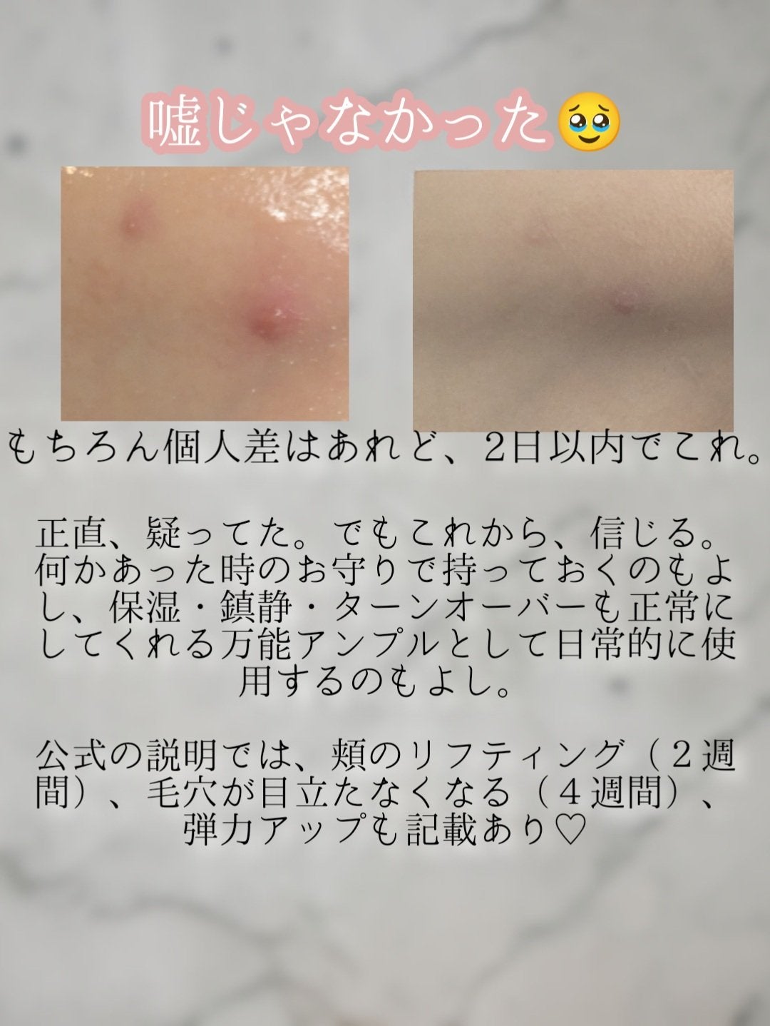 SOSメルダーシステム/KOPHER/フェイスクリームを使ったクチコミ(6枚目)