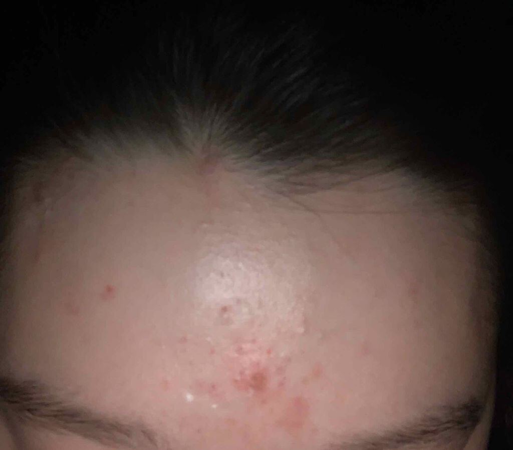 トレリアン モイスチャー ローション/ラ ロッシュ ポゼ/化粧水を使ったクチコミ（2枚目）