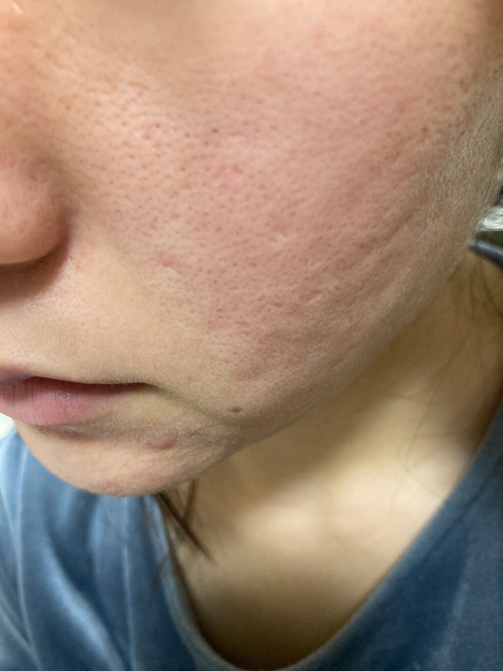 オバジC10セラム/オバジ/美容液を使ったクチコミ(4枚目)