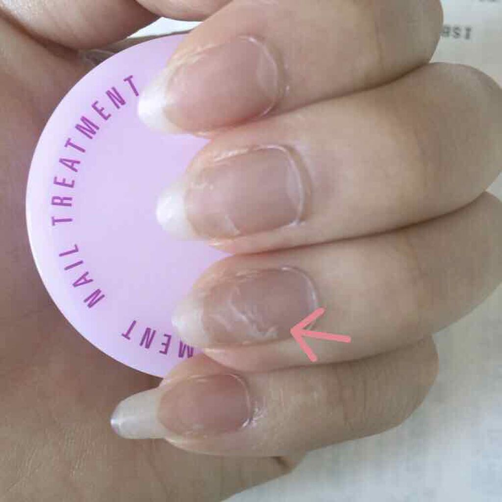 ネイルオイル/ベリンダ/ネイルオイル・トリートメントを使ったクチコミ（2枚目）