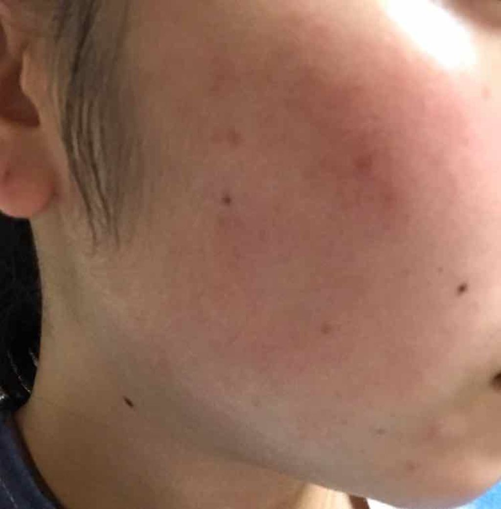 エンハンサー/ニュースキン/美容液を使ったクチコミ（2枚目）