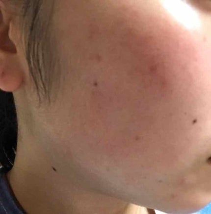 エンハンサー/ニュースキン/美容液を使ったクチコミ(2枚目)