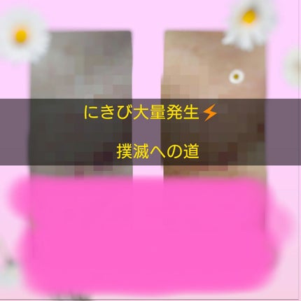 VCスターターセット/VCシリーズ/スキンケアキットを使ったクチコミ(1枚目)