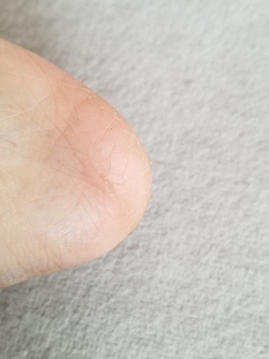 グリセリンカリ液/健栄製薬/ハンドクリームを使ったクチコミ（3枚目）