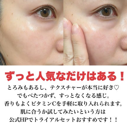 VC100エッセンスローション EX/ドクターシーラボⓇ/化粧水を使ったクチコミ(5枚目)