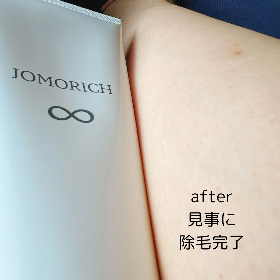 ジョモリッチ/鎌倉ライフ/除毛クリームを使ったクチコミ(6枚目)