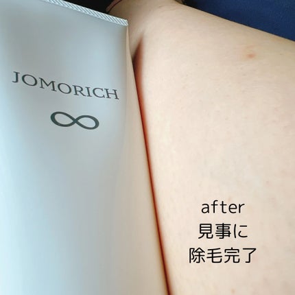ジョモリッチ/鎌倉ライフ/除毛クリームを使ったクチコミ(6枚目)