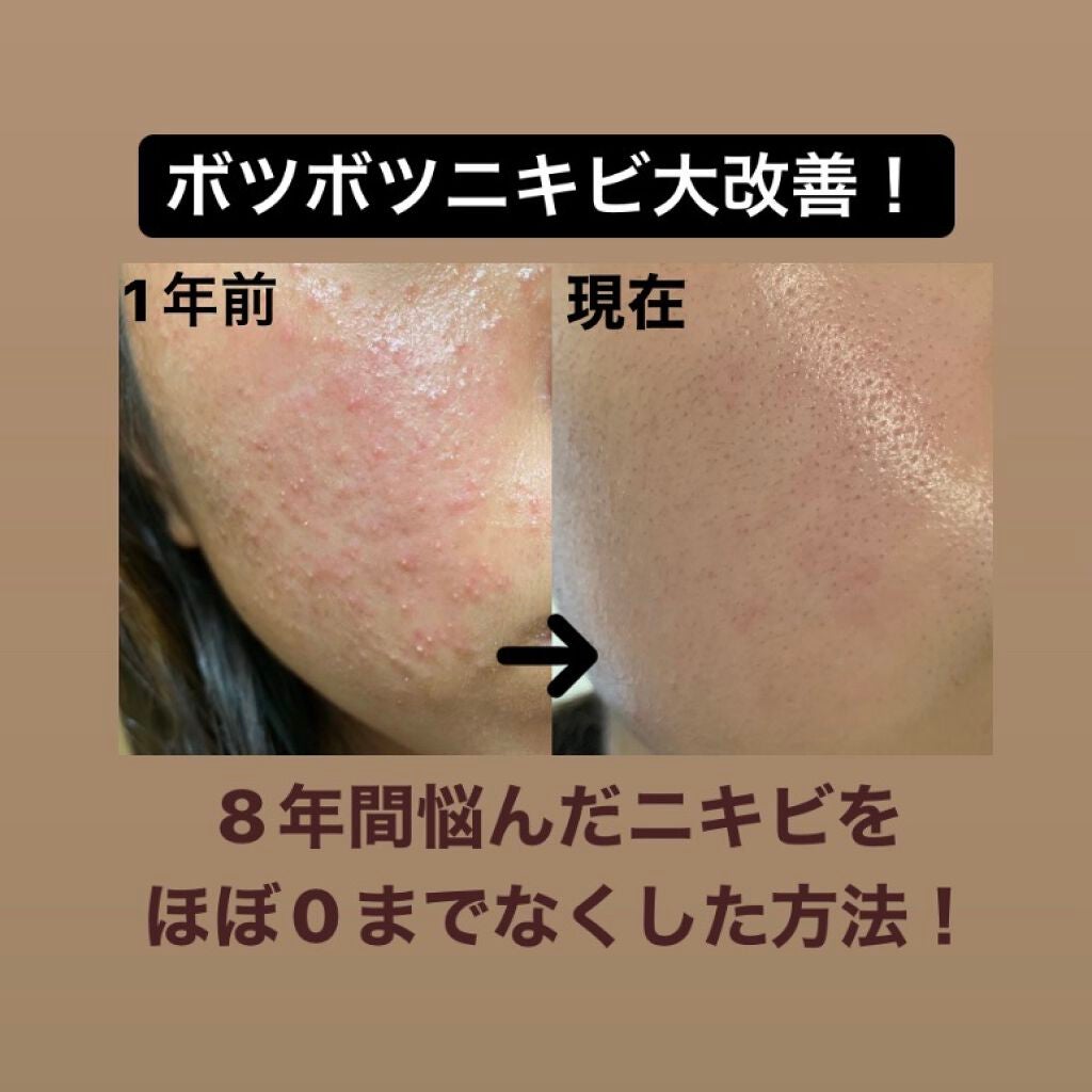 DHC ビタミンCハードカプセル/DHC/美容サプリメントを使ったクチコミ(1枚目)