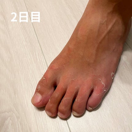 あしやすめ 足裏角質ケアパック/鎌倉ライフ/レッグ・フットケアを使ったクチコミ(4枚目)