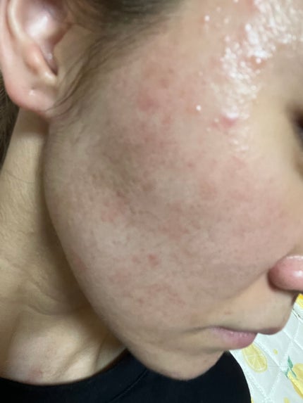 を使ったクチコミ(2枚目)