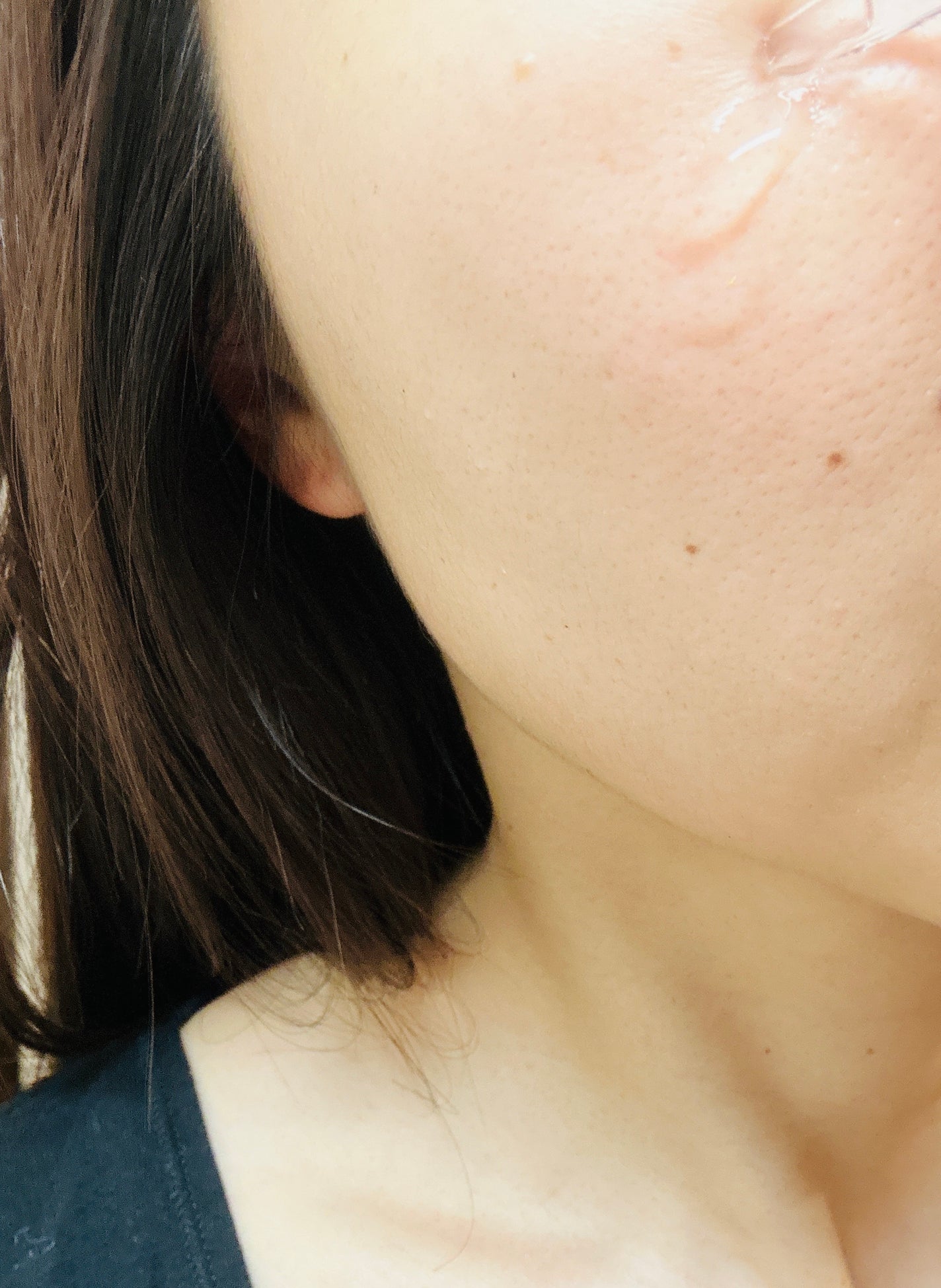 ゆいた on LIPS 「レビュトレ様からいただきました。初めての高級美容液。#PR#E..」(4枚目)