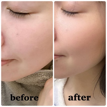 ビタペアCデイリーシートマスク/ネイチャーリパブリック/シートマスク・パックを使ったクチコミ(9枚目)