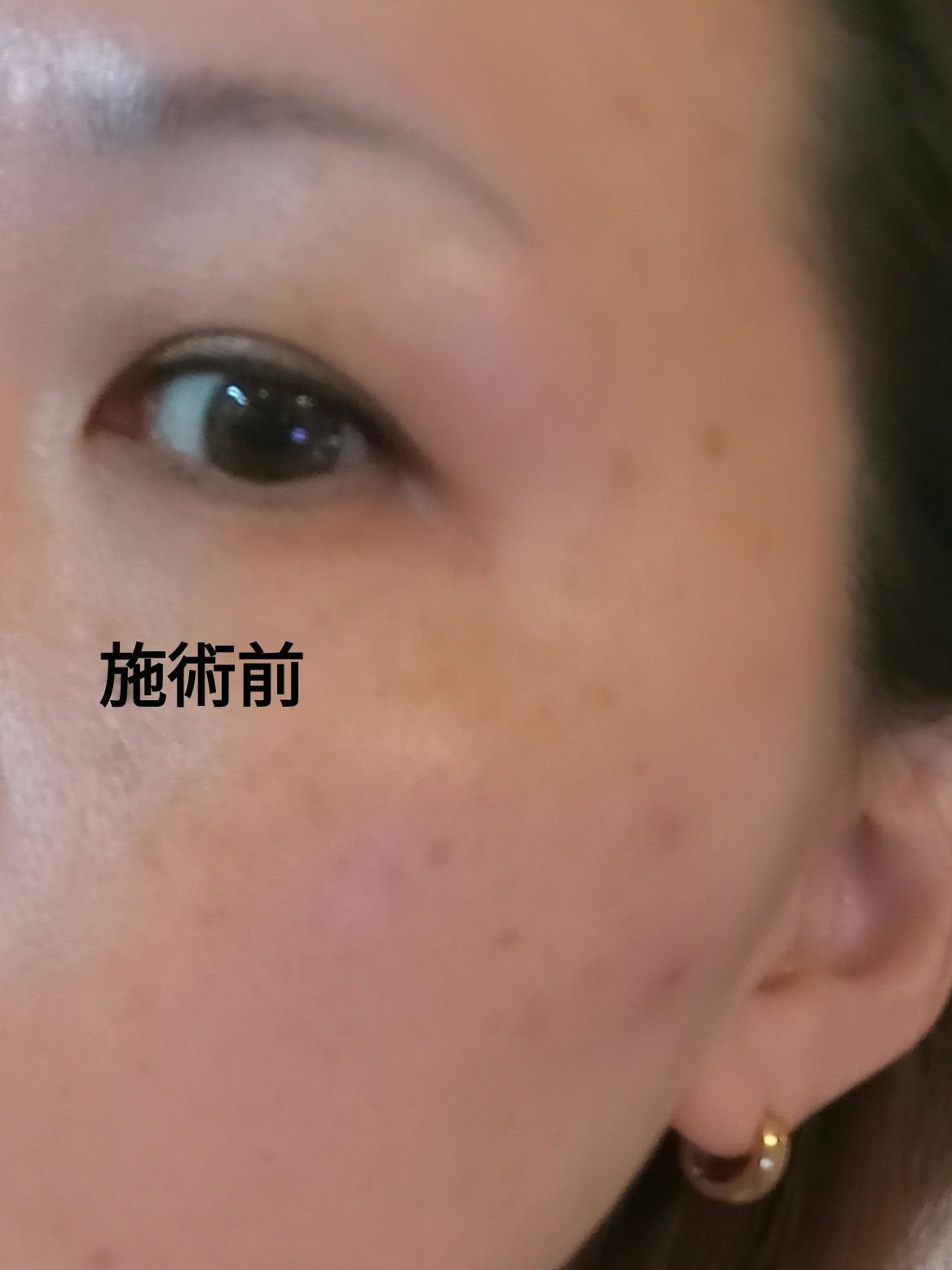 アイディクト byフェアリー/FAIRY/カラーコンタクトレンズを使ったクチコミ(4枚目)