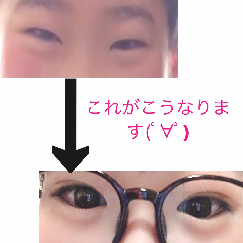 アイトーク/アイトーク/二重まぶた用アイテムを使ったクチコミ(2枚目)