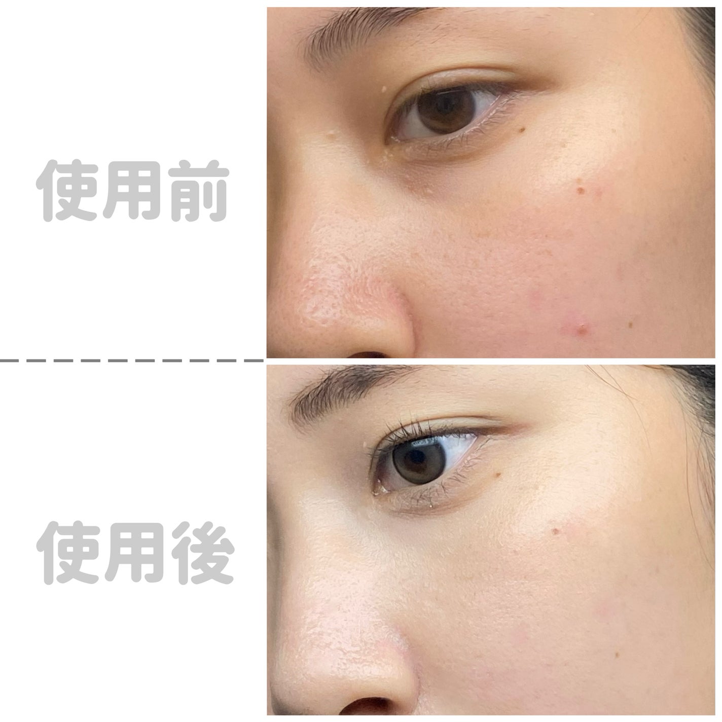 ピンクティーツリーカバークッション/APLIN/クッションファンデーションを使ったクチコミ(2枚目)