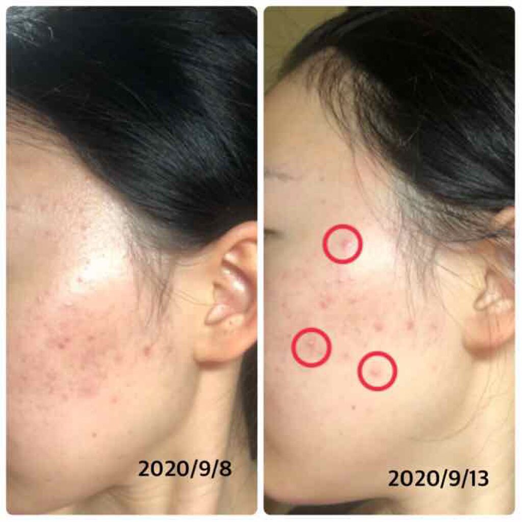 ザ・タイムR アクア/IPSA/化粧水を使ったクチコミ(2枚目)