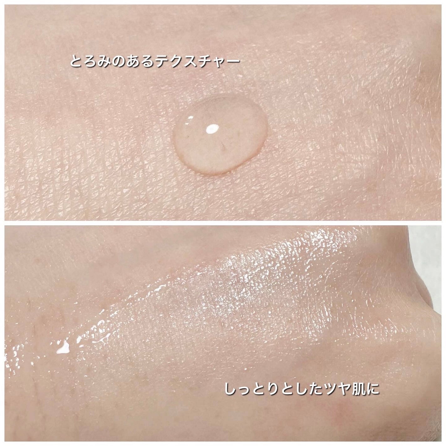 グルカミューンエッセンス /VT/美容液を使ったクチコミ(3枚目)