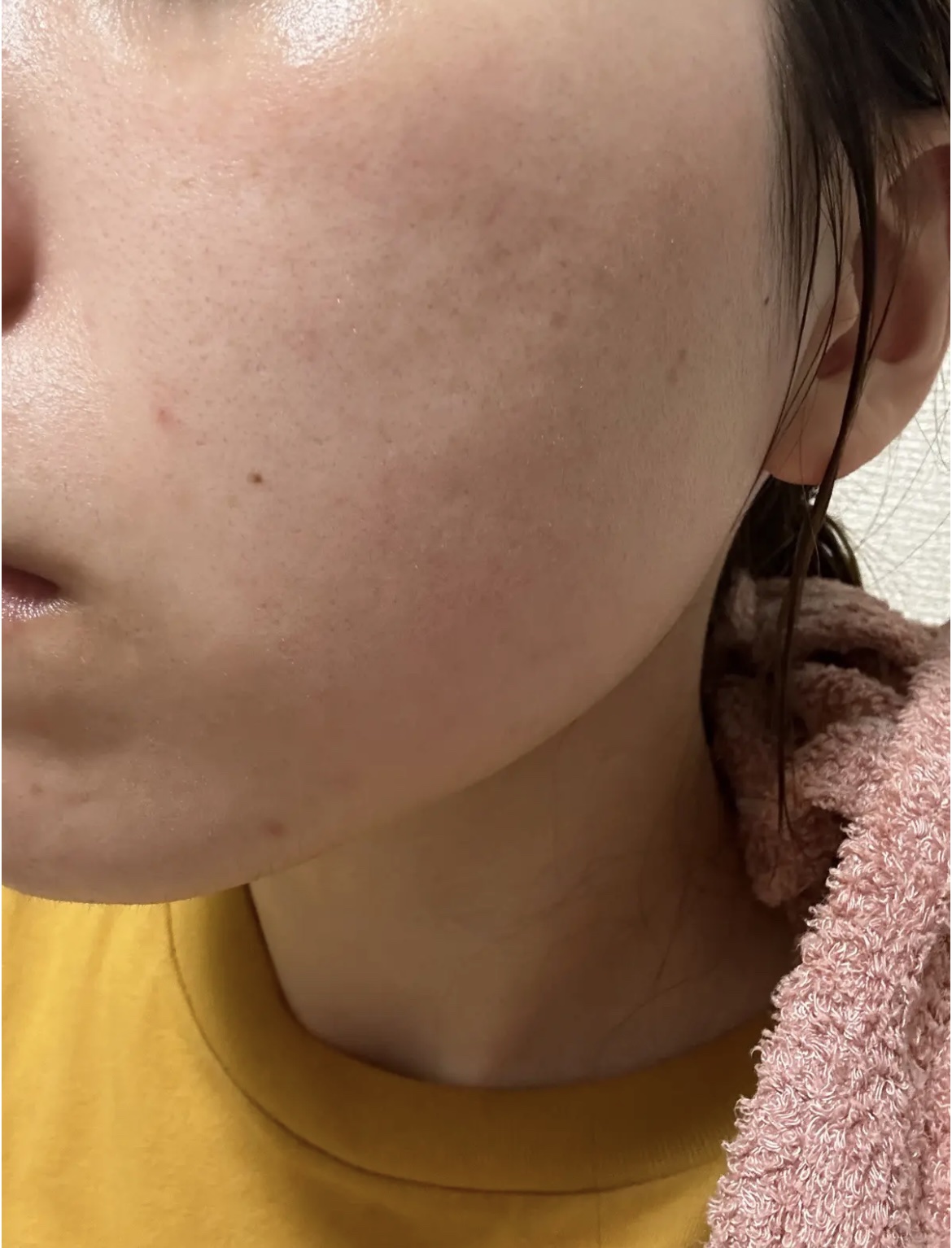 薬用しみ集中対策 プレミアム美容液/メラノCC/美容液を使ったクチコミ（3枚目）