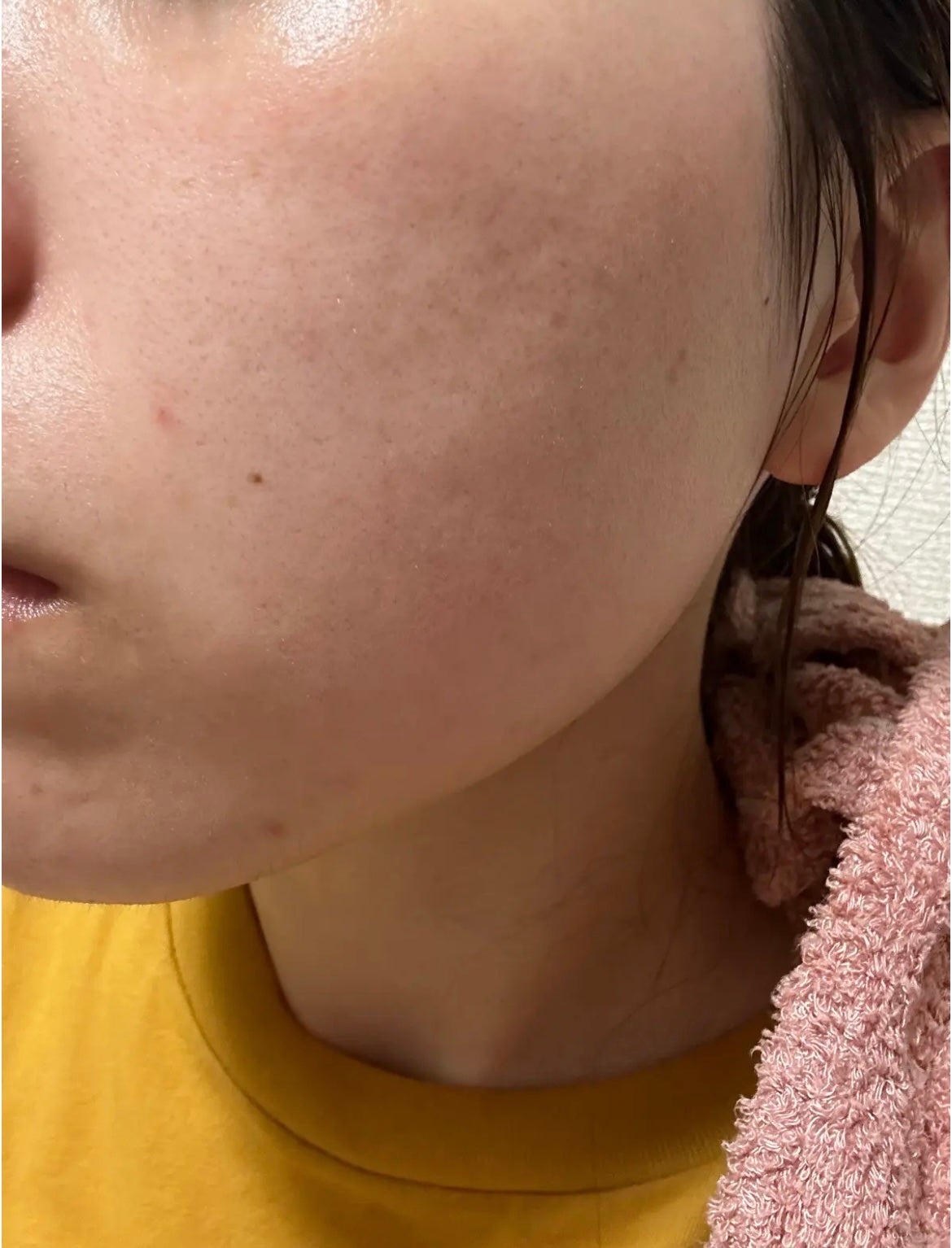 薬用しみ集中対策 プレミアム美容液/メラノCC/美容液を使ったクチコミ(3枚目)