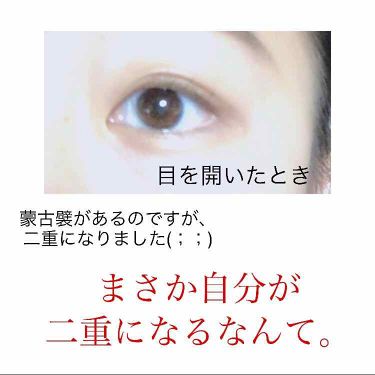のび る アイテープ 絆創膏タイプ Daisoの口コミ 超優秀 100均で買えるおすすめ二重まぶた用アイテム 目のアップ写真ありま By ぽりぶくろ 混合肌 10代後半 Lips