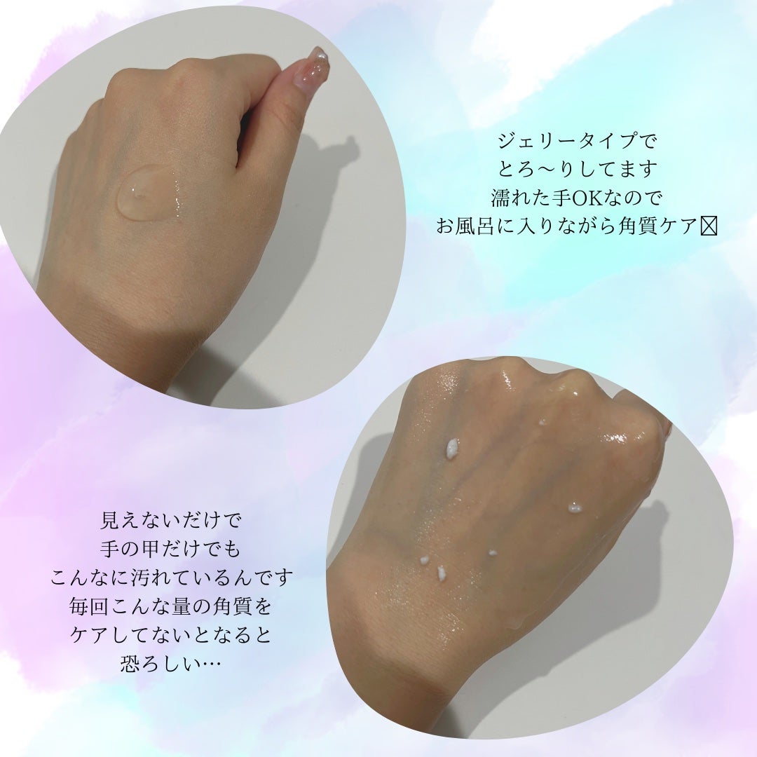 DETクリア ブライト&ピール ピーリングジェリー<無香料タイプ>/Detclear/ピーリングを使ったクチコミ(2枚目)