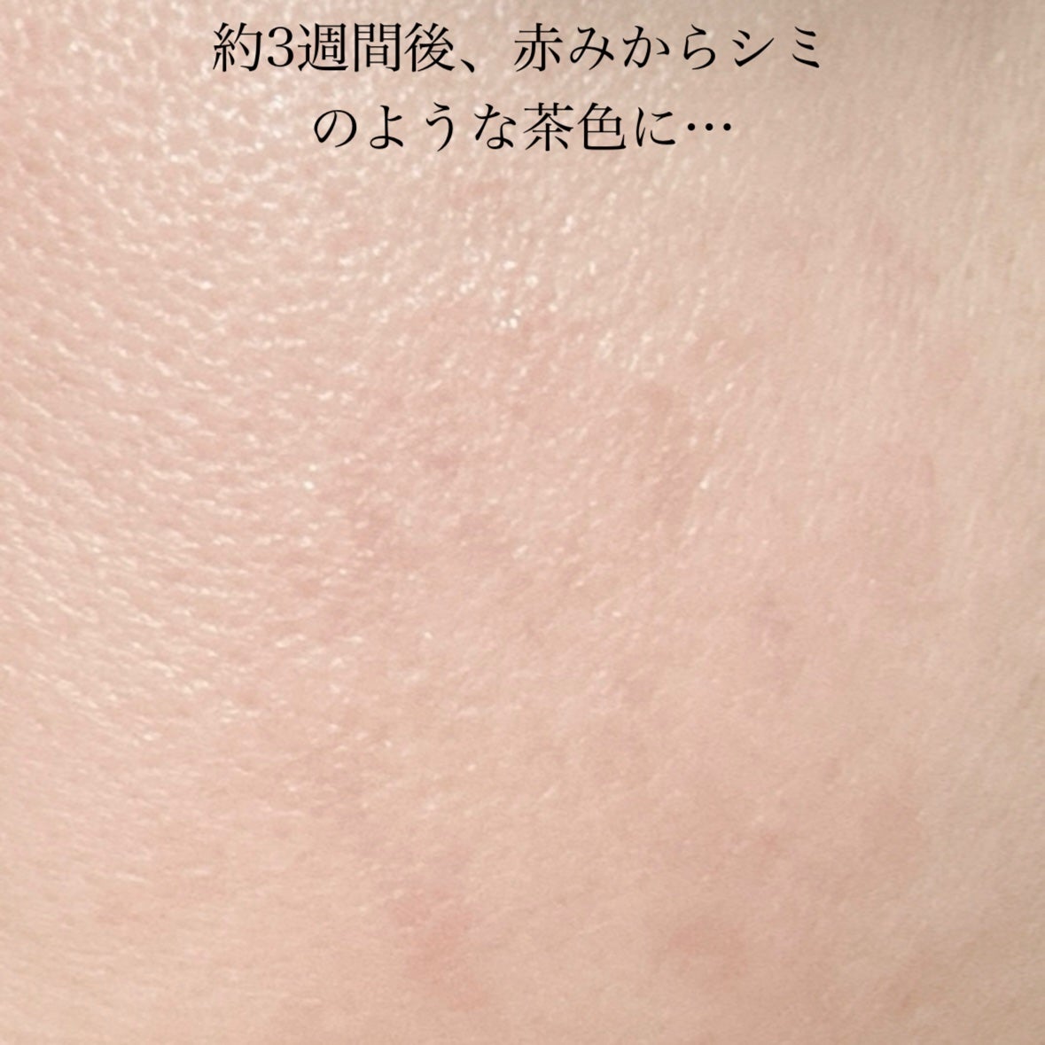 レチノール シカ リペア セラム/innisfree/美容液を使ったクチコミ(6枚目)