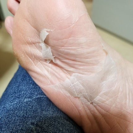 かかと どうスルん??そうスルんDX/Stay Free/レッグ・フットケアを使ったクチコミ(3枚目)