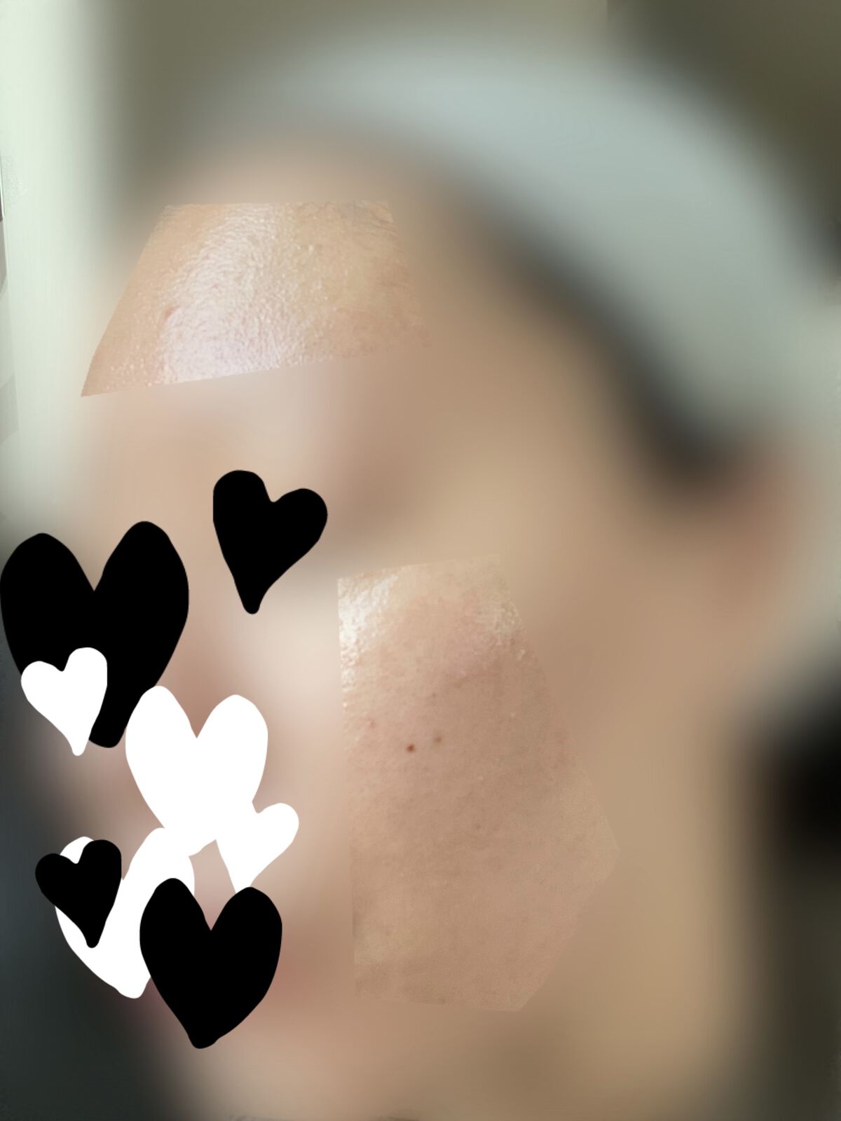 ルルルン ハイドラ V マスク/ルルルン/シートマスク・パックを使ったクチコミ（3枚目）