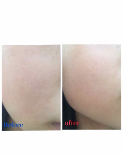 スキンアクア トーンアップUVエッセンス/スキンアクア/日焼け止めクリームを使ったクチコミ(3枚目)