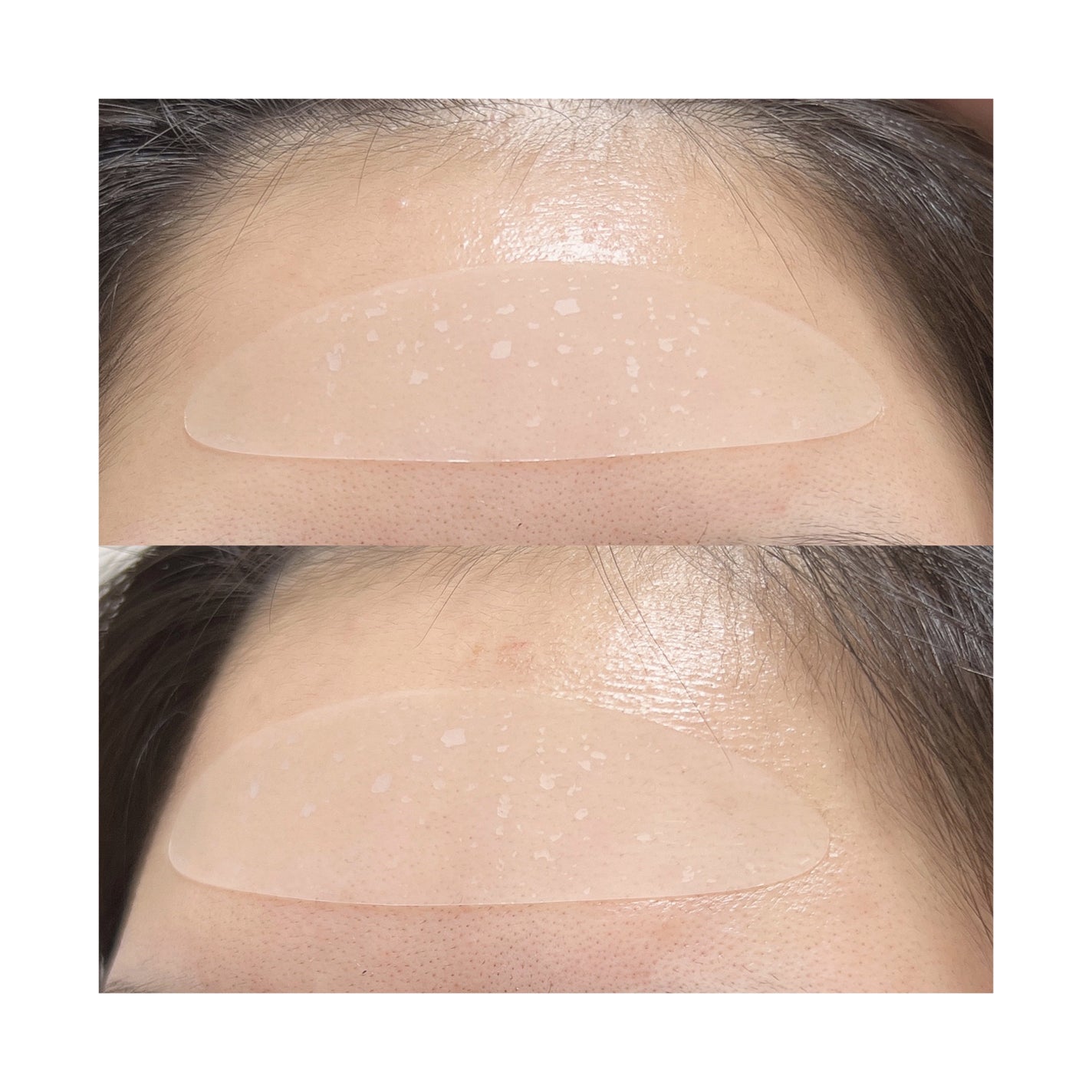 リンクルリペアしわパッチ/MARSHIQUE/その他スキンケアを使ったクチコミ(3枚目)