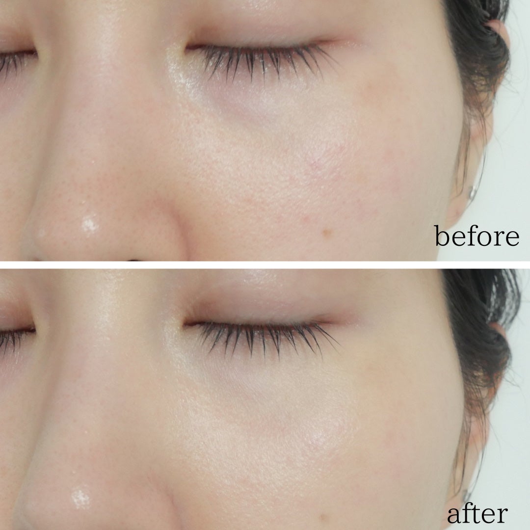 ザ マルチタスカー コンシーラー/リンメル ロンドン/リキッドコンシーラーを使ったクチコミ(8枚目)