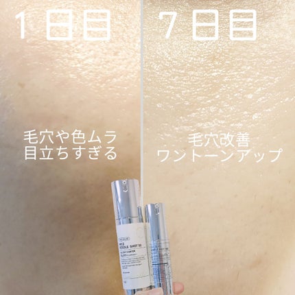 マイルドリードルショット50/VT/美容液を使ったクチコミ(5枚目)