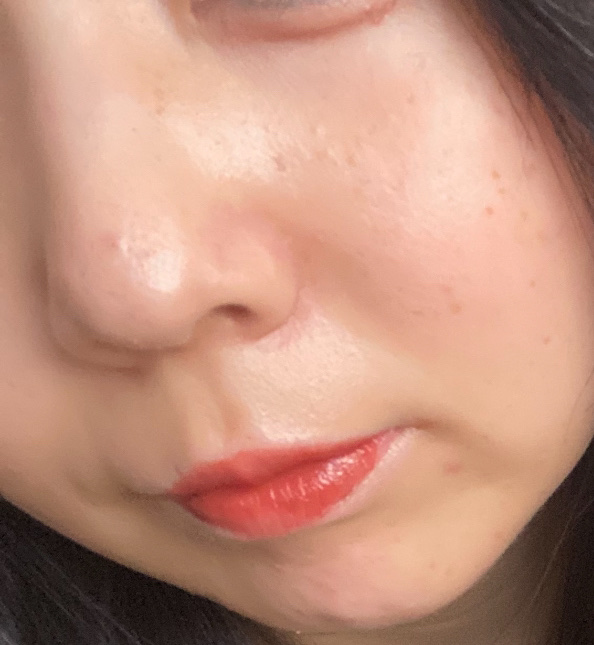 オードムーゲ 薬用ローション（ふきとり化粧水）/オードムーゲ/拭き取り化粧水を使ったクチコミ（2枚目）