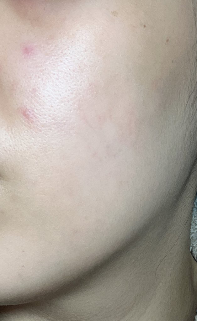 スキン リリーフ エッセンス/Dr.Althea/美容液を使ったクチコミ（3枚目）