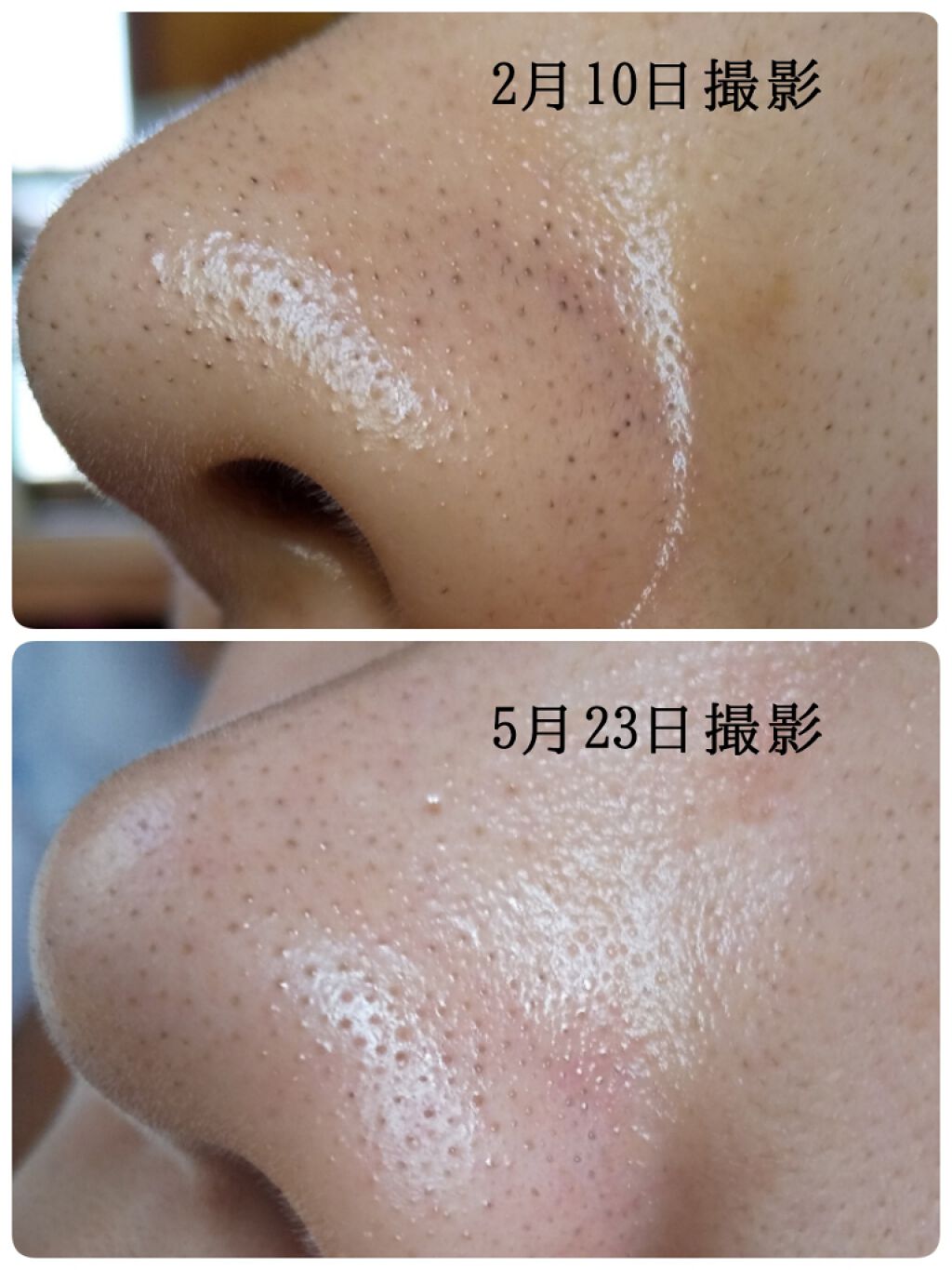 デュオ ザ クレンジングバーム クリア/DUO/クレンジングバームを使ったクチコミ(2枚目)