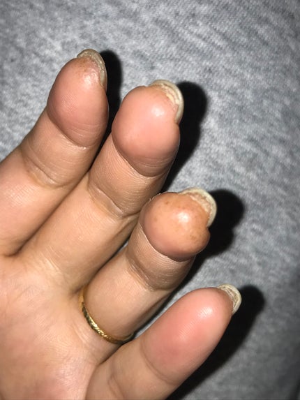 ジェルネイル(ライト対応)/セリア/ジェルネイルを使ったクチコミ(2枚目)