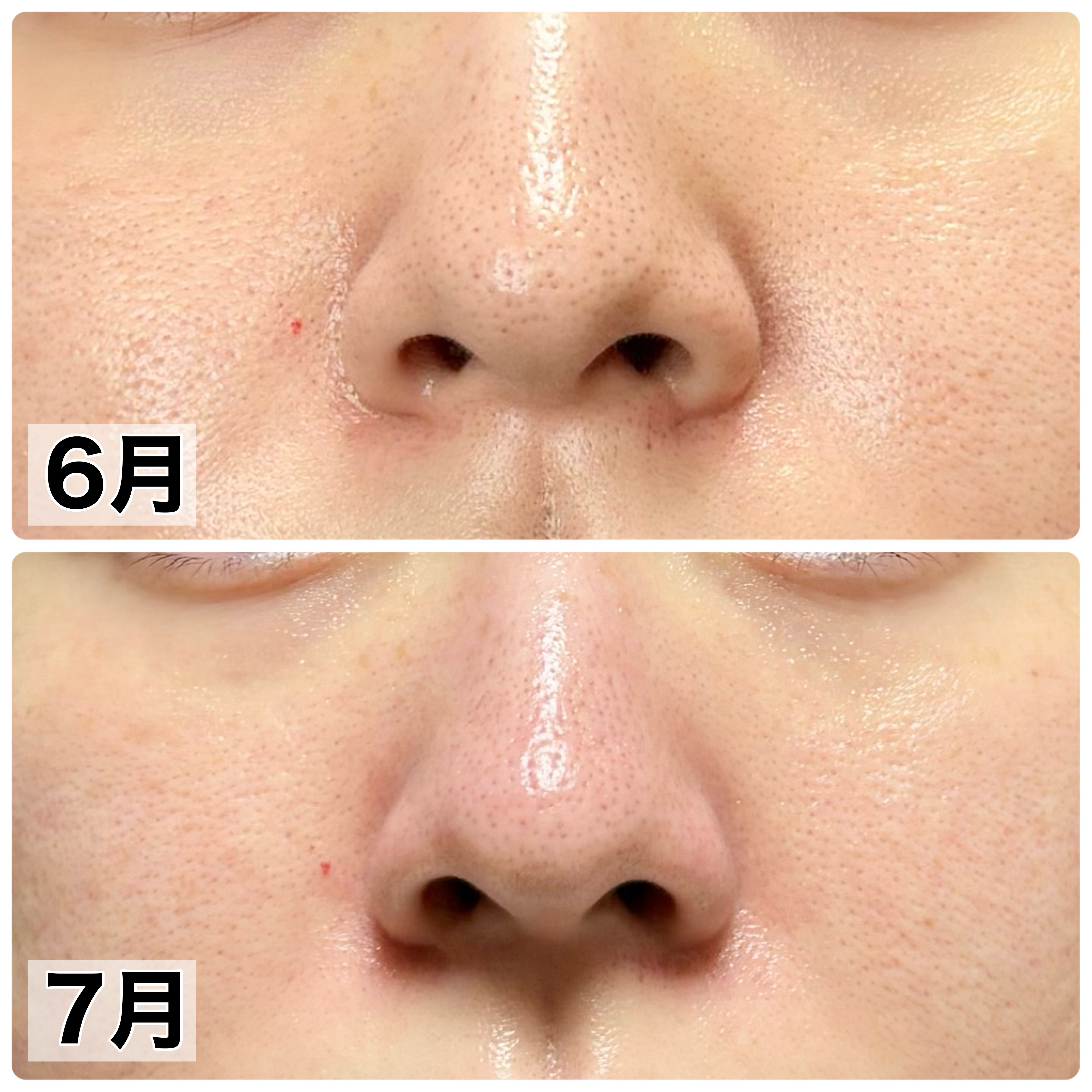 コラーゲン原液/グラマティカル/美容液を使ったクチコミ（2枚目）