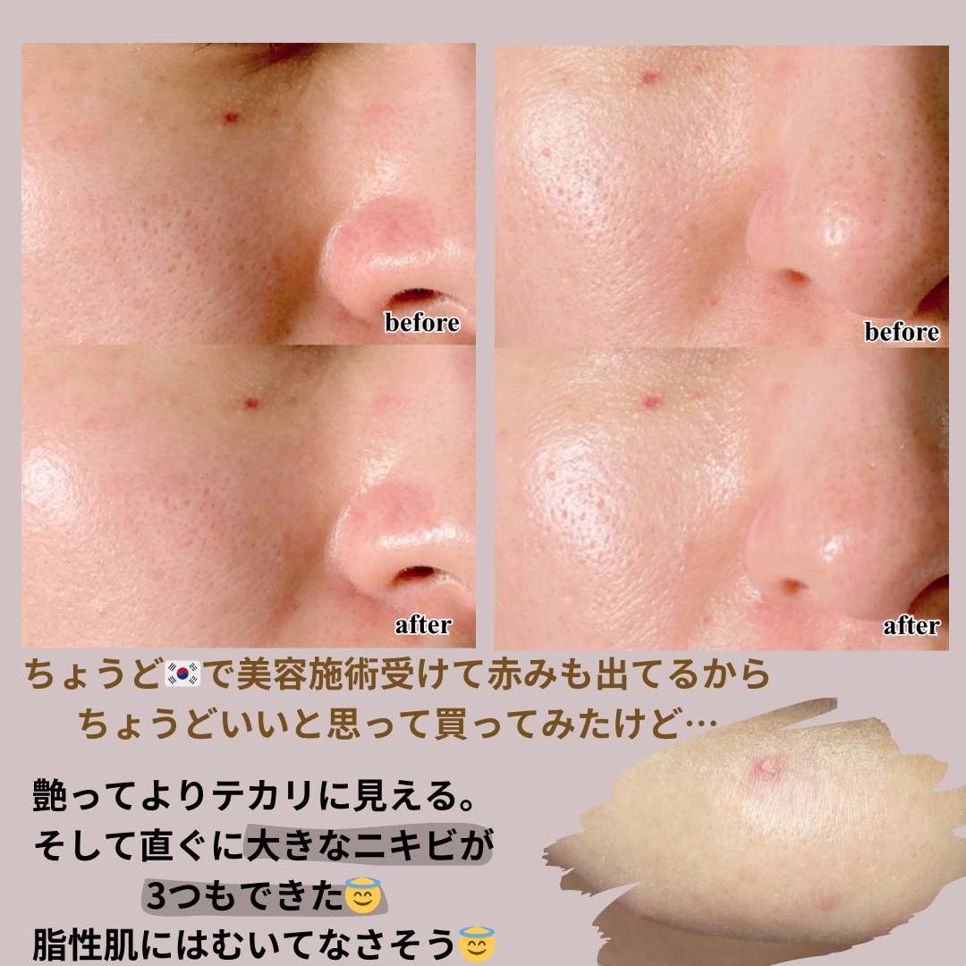 リリーフサンライス + プロバイオティクス/Beauty of Joseon/日焼け止めクリームを使ったクチコミ（2枚目）