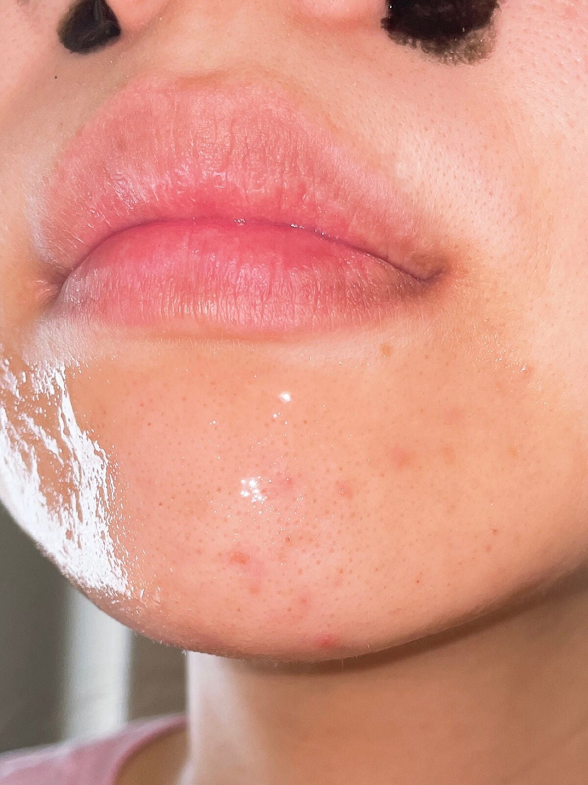 毛穴小町 ブラックピールオフパック/クリアターン/ピーリングを使ったクチコミ(6枚目)