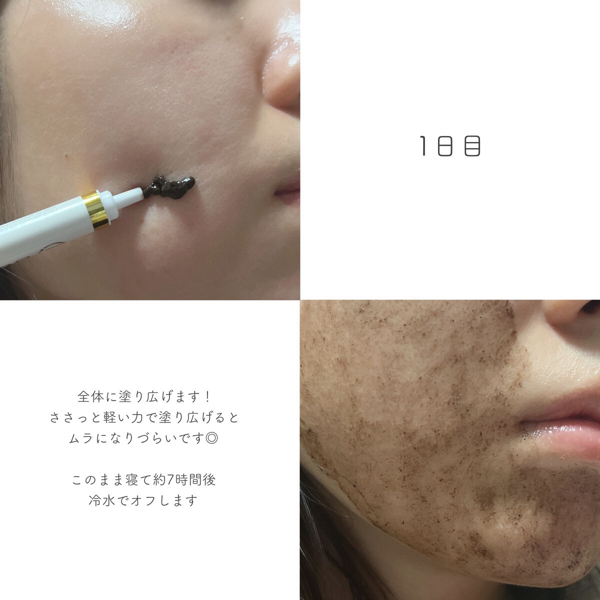 ダーマスキンピーリング/BQCELL/その他キットセットを使ったクチコミ（3枚目）