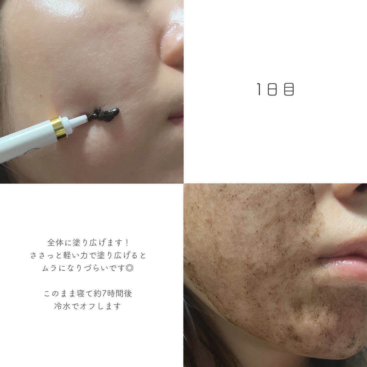 ダーマスキンピーリング/BQCELL/その他キットセットを使ったクチコミ(3枚目)