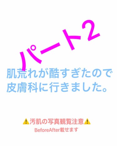 たけだ※たまに投稿 on LIPS 「⚠️肌の写真載せてます⚠️気をつけてみてください🙇‍♀️写真は..」（1枚目）