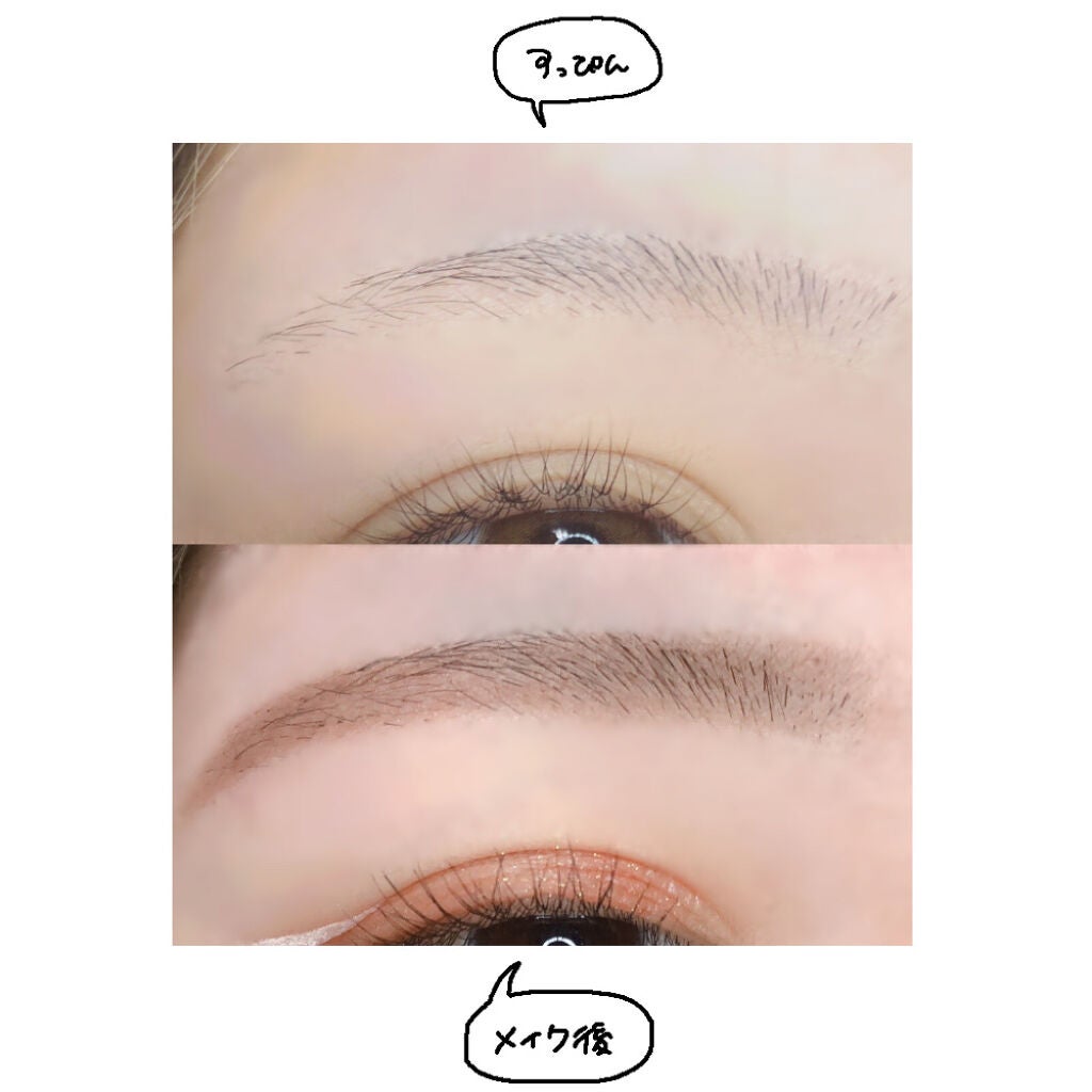 プレミア敏感肌用 Lディスポ/シック/シェーバーを使ったクチコミ(3枚目)