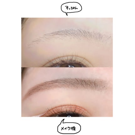 プレミア敏感肌用 Lディスポ/シック/シェーバーを使ったクチコミ(3枚目)