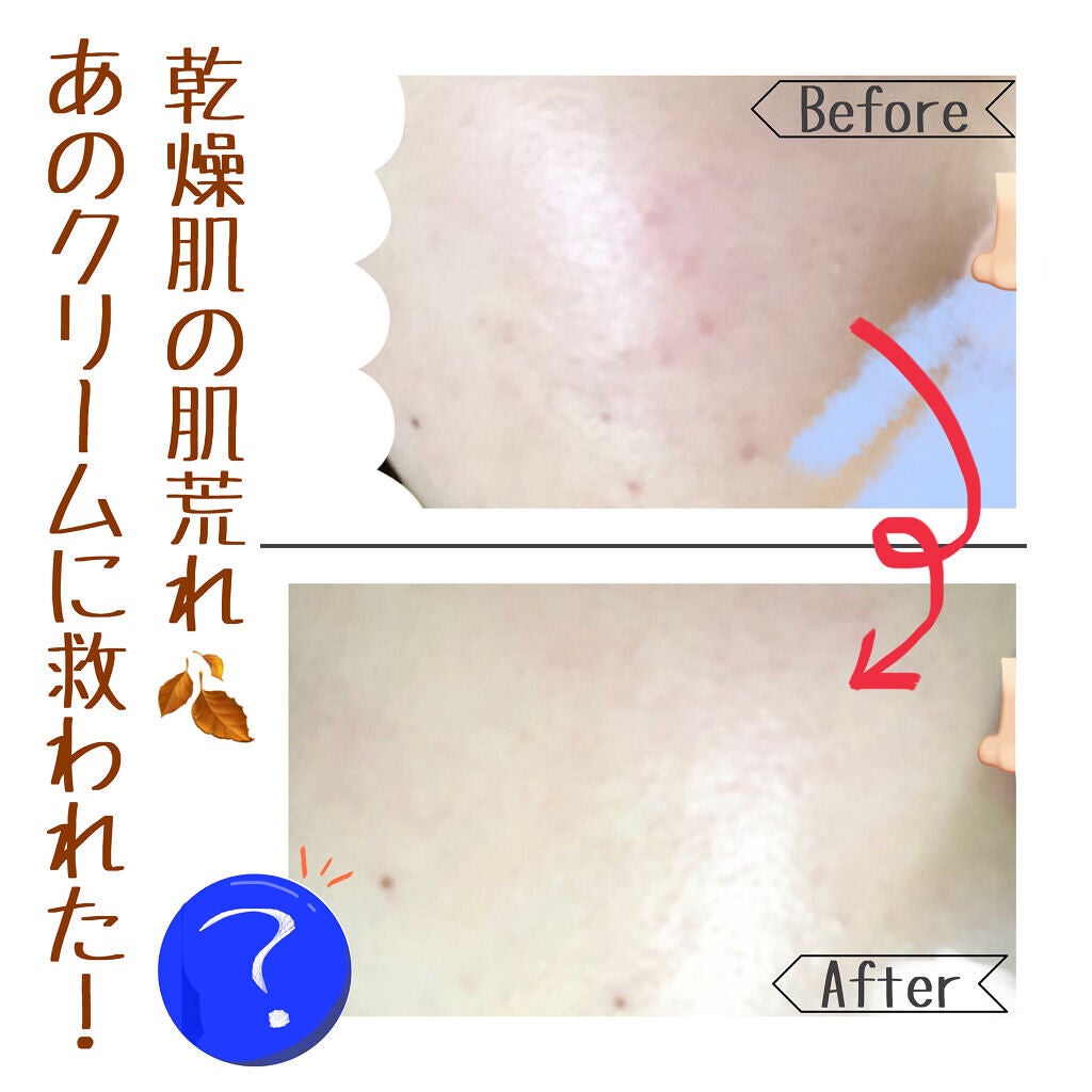 ニベアクリーム/ニベア/ボディクリームを使ったクチコミ(1枚目)