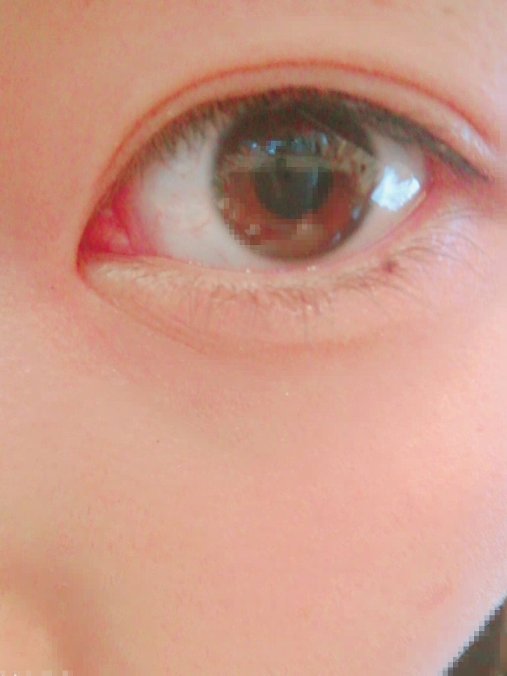 二重まぶた用シール/DAISO/二重まぶた用アイテムを使ったクチコミ(3枚目)